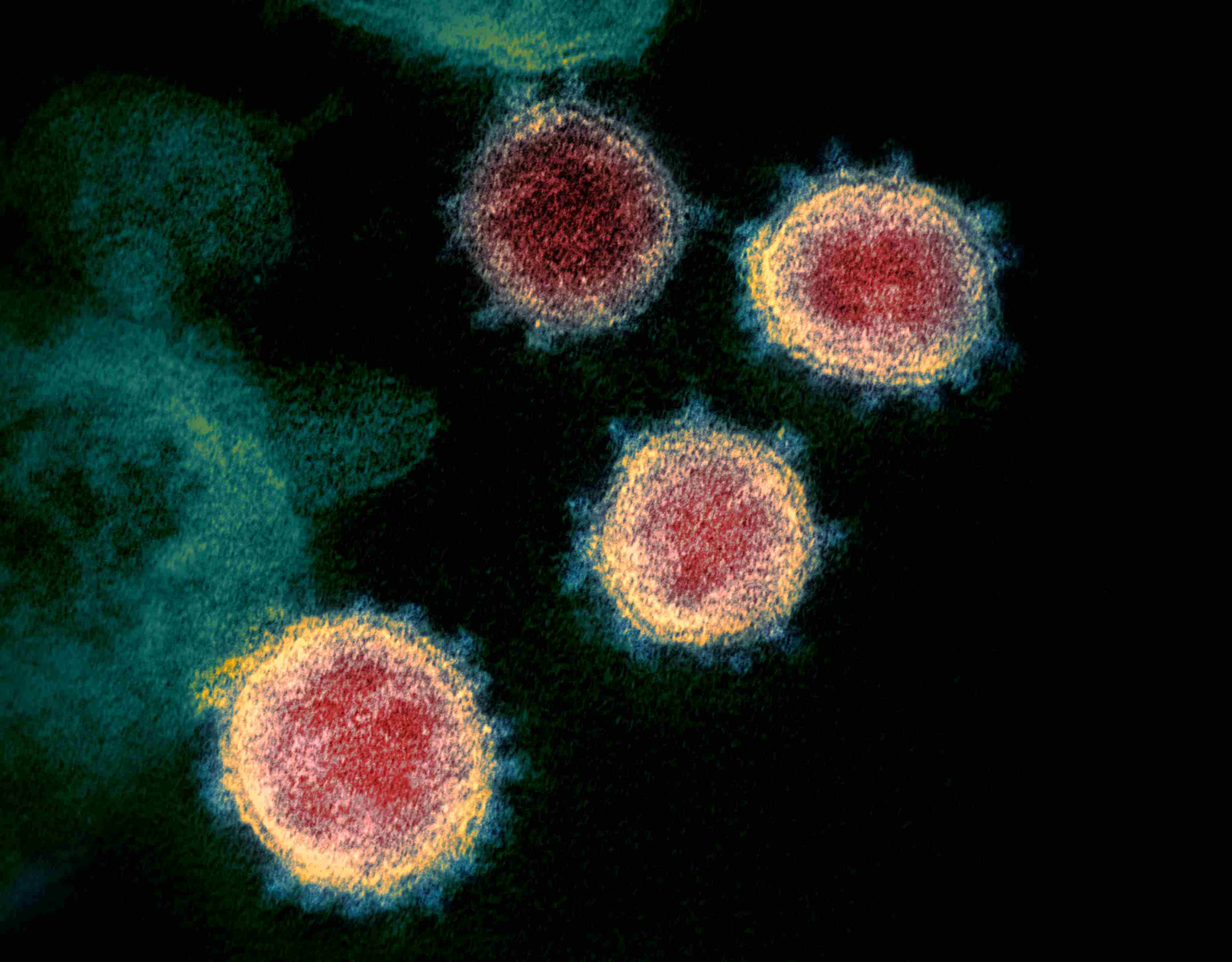 Images Wikimedia Commons/24 NIAID-RML Novel_Coronavirus_SARS-CoV-2.jpg